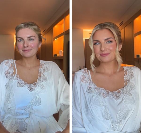 Before and After